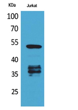 p53 (Acetyl Lys370) antibody