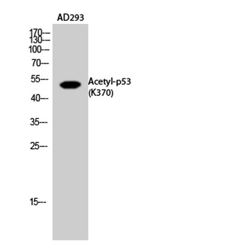 p53 (Acetyl Lys370) antibody