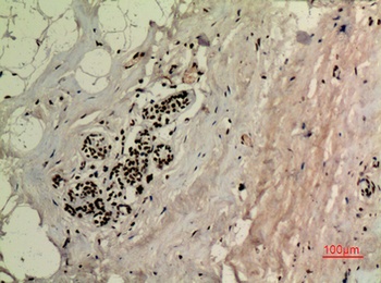 p53 (Acetyl Lys370) rabbit pAb