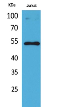 p53 (Acetyl Lys372) antibody