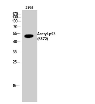 p53 (Acetyl Lys372) antibody