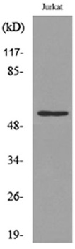 p53 (Acetyl Lys372) antibody
