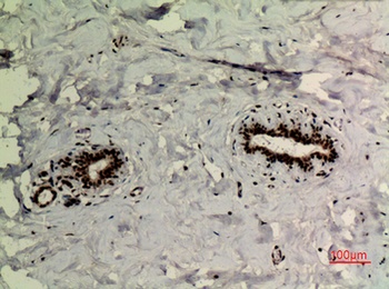 p73 (Acetyl Lys321) antibody