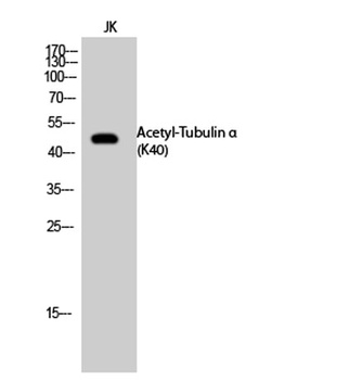 Tubulin alpha (Acetyl Lys40) antibody