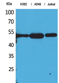 Tubulin α (Acetyl Lys352) rabbit pAb