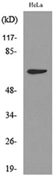 Cytokeratin-pan (Acetyl Lys194) rabbit pAb