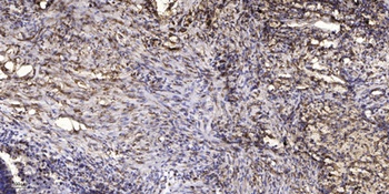 Ku-70 (Acetyl Lys331) rabbit pAb