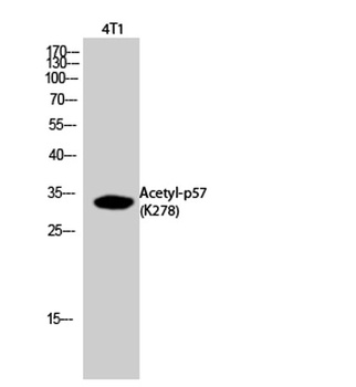 p57 (Acetyl Lys278) rabbit pAb Antibody