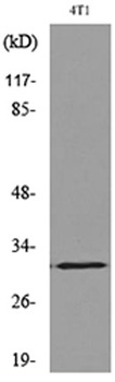 p57 (Acetyl Lys278) antibody