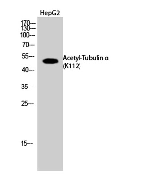 Tubulin α (Acetyl Lys112) rabbit pAb Antibody