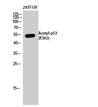 p53 (Acetyl Lys382) antibody