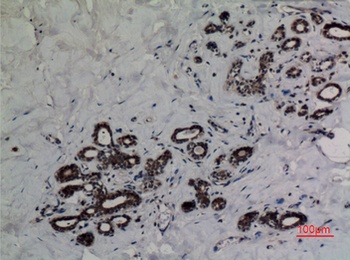 p53 (Acetyl Lys382) antibody