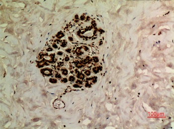 Ub (Acetyl Lys27) antibody