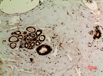 Ub (Acetyl Lys27) rabbit pAb