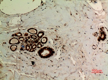 Ub (Acetyl Lys27) antibody