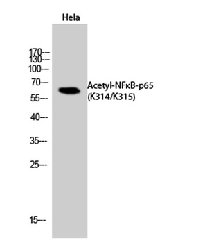 NFκB-p65 (Acetyl Lys314/Lys315) rabbit pAb