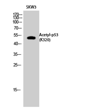 p53 (Acetyl Lys320) antibody