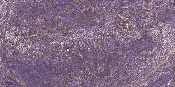 PCAF (Acetyl Lys428) rabbit pAb