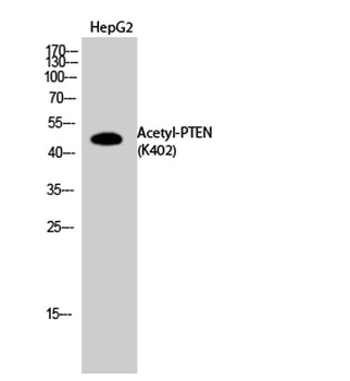 PTEN (Acetyl Lys402) rabbit pAb
