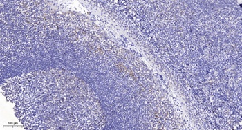 PTEN (Acetyl Lys402) antibody
