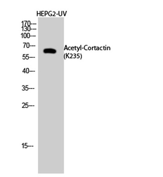 Cortactin (Acetyl Lys235) rabbit pAb