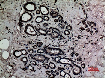 HMG-1 (Acetyl Lys12) rabbit pAb