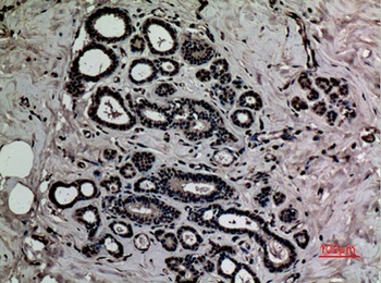 HMG-1 (Acetyl Lys12) antibody