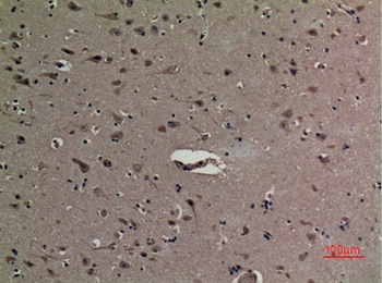 HMG-1 (Acetyl Lys12) rabbit pAb