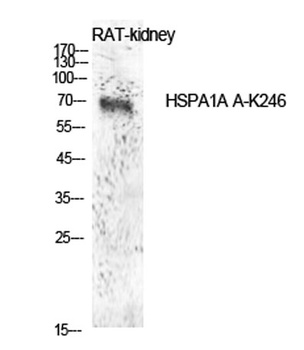 HSP70 (Acetyl Lys246) rabbit pAb Antibody