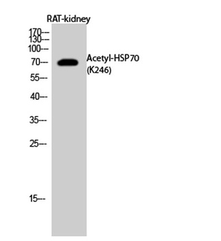HSP70 (Acetyl Lys246) antibody