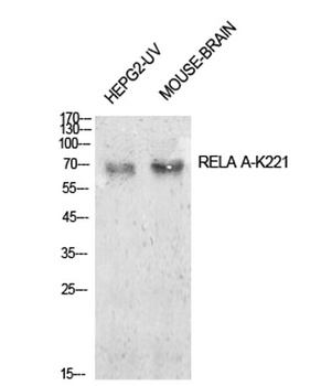 NFκB-p65 (Acetyl Lys221) rabbit pAb Antibody