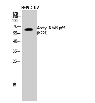 NFκB-p65 (Acetyl Lys221) rabbit pAb Antibody