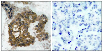 Akt2 (phospho Ser474) rabbit pAb Antibody