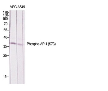 AP-1/Jun D (phospho Ser73/100) rabbit pAb