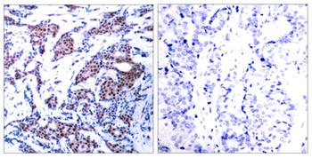 AP-1/Jun D (phospho-Ser73/100) antibody