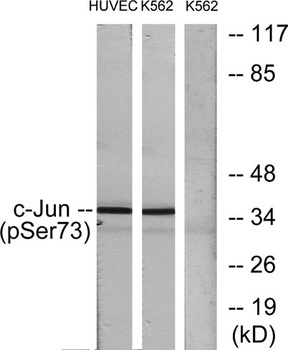 AP-1/Jun D (phospho Ser73/100) rabbit pAb