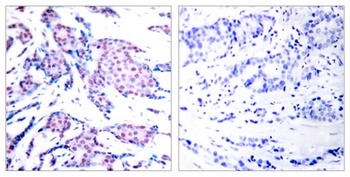 AP-1 (phospho Thr93) rabbit pAb