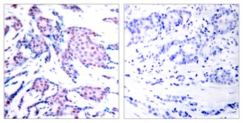 AP-1 (phospho-Thr93) antibody