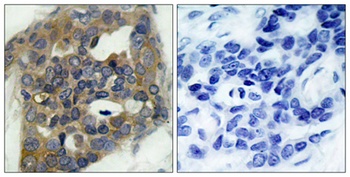 ASK 1 (phospho Ser966) rabbit pAb