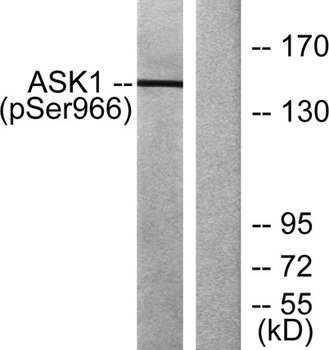 ASK 1 (phospho Ser966) rabbit pAb