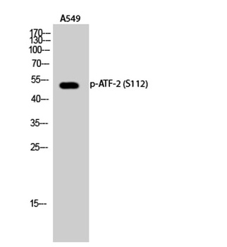 ATF-2 (phospho Ser112) rabbit pAb