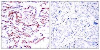 ATF-2 (phospho Ser112) rabbit pAb