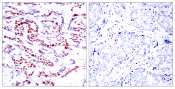 ATF-2 (phospho-Ser112) antibody