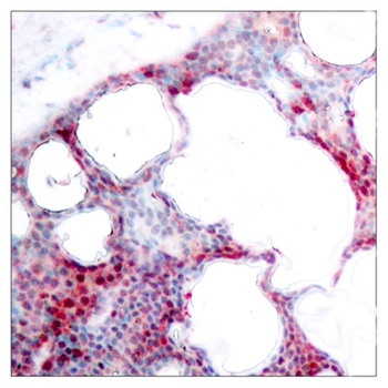ATF-2 (phospho Ser62) rabbit pAb