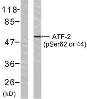 ATF-2 (phospho Ser62) rabbit pAb