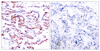 ATF-2 (phospho Thr71) rabbit pAb