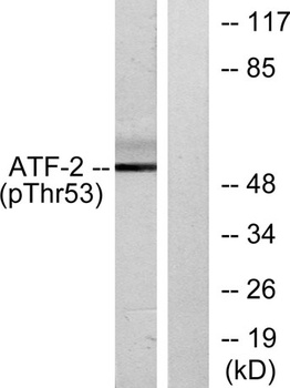ATF-2 (phospho Thr71) rabbit pAb