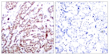 ATF-2 (phospho Thr73) rabbit pAb