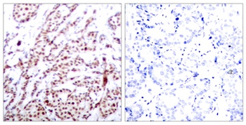 ATF-2 (phospho-Thr73) antibody