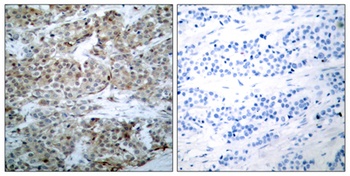 Bad (phospho-Ser112) antibody